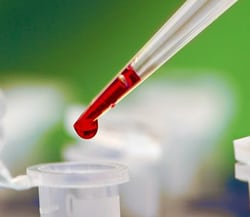 Анализы на инсулин: как правильно сдавать кровь, расшифровка теста, цена и подготовка