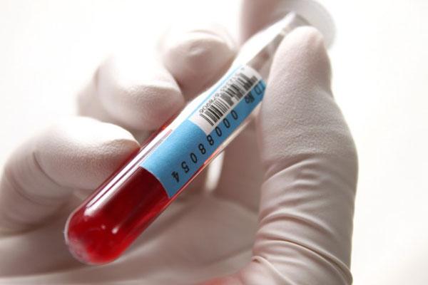 Анализы при панкреатите: какие должны быть показатели в биохимии крови