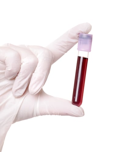 Экспресс анализ на сахар в крови: цена теста полоски для определения глюкозы в аптеке