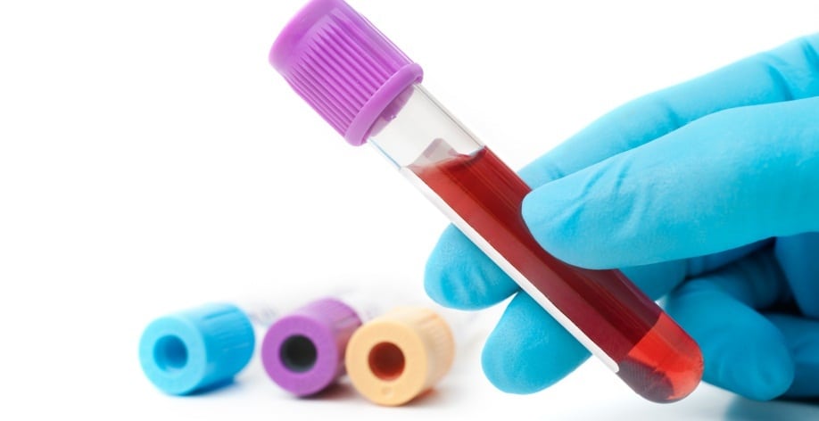 Экспресс анализ на холестерин: как правильно сдавать кровь на биохимическое исследование
