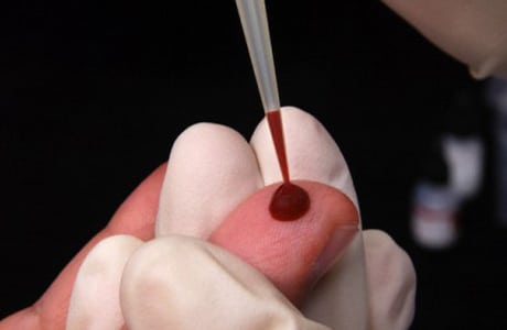Норма сахара в крови у мужчин после 70 лет из пальца: таблица уровней