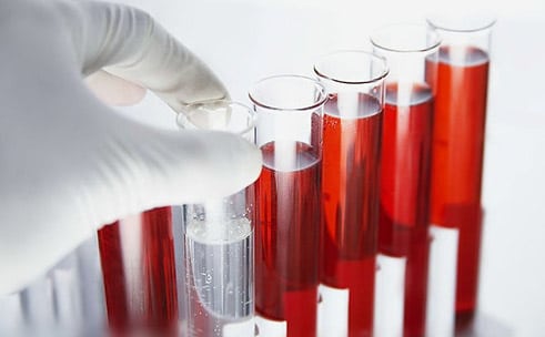 Клинический анализ крови показывает сахар в крови thumbnail